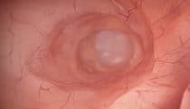 A Tour of the Gastrointestinal Tract
