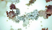 Protein-eating enzyme