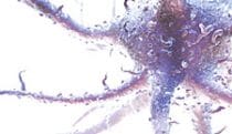 Dendritic cell