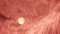 Egg in fallopian tube