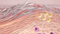 Psoriatic plaque formation MOA