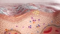 Keratinocytes and immune cells