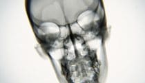 X-ray Body in Motion