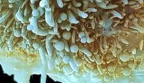 Malignant Cell