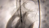 Fluoroscopy