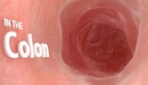360° VR animation | Inside the GI tract