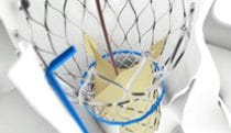 Prosthetic device analysis in VR