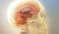 Protecting against concussions
