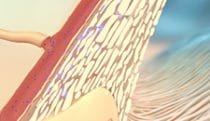 Dual action glaucoma therapy MOA