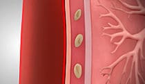 Airway Clearance System