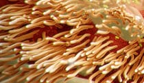 Bordetella pertussis