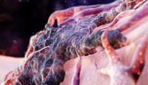Nanoparticle delivery & tumor death