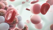 Malignant plasma cells