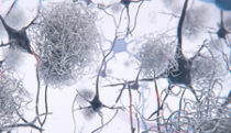 Aβ aggregates & Alzheimer’s disease