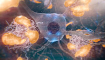 Microglial engulfment of Aβ plaques